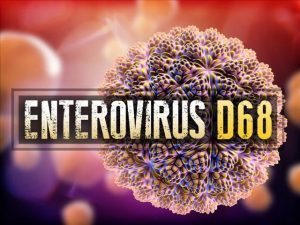 enterovirus-d68