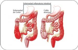 intestino1