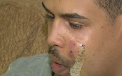 Le cortan la cara con un cristal a un joven de Majadahonda por negarse a darle el móvil y dinero a 3 magrebíes: madrugada en Moncloa