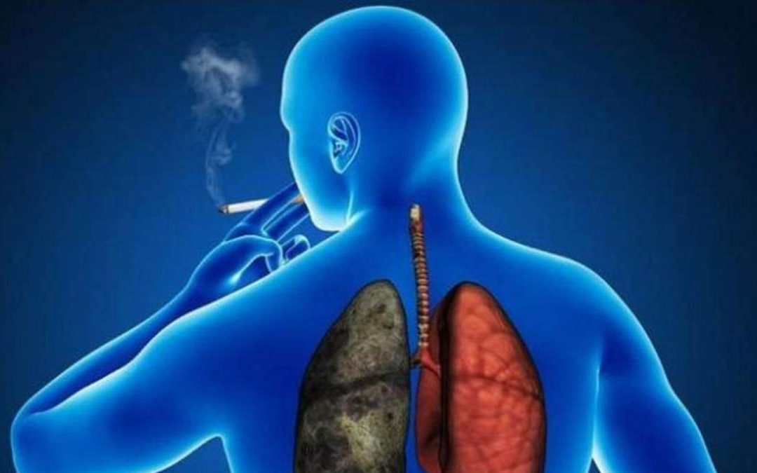 Pacientes del Hospital Puerta de Hierro Majadahonda participan en un estudio: 2 años más de vida con cáncer de pulmón