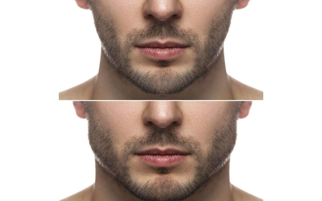 Tendencias emergentes y enfoques personalizados en la medicina estética masculina