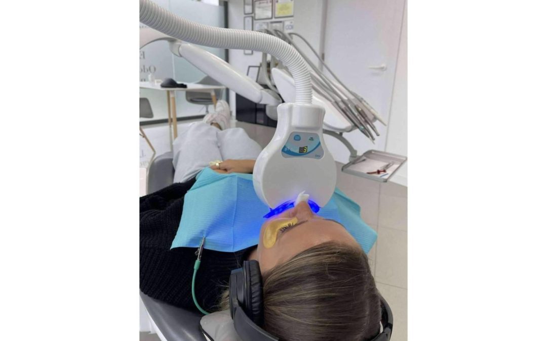 Clínica MG Dental y sus servicios de higiene y blanqueamiento dental