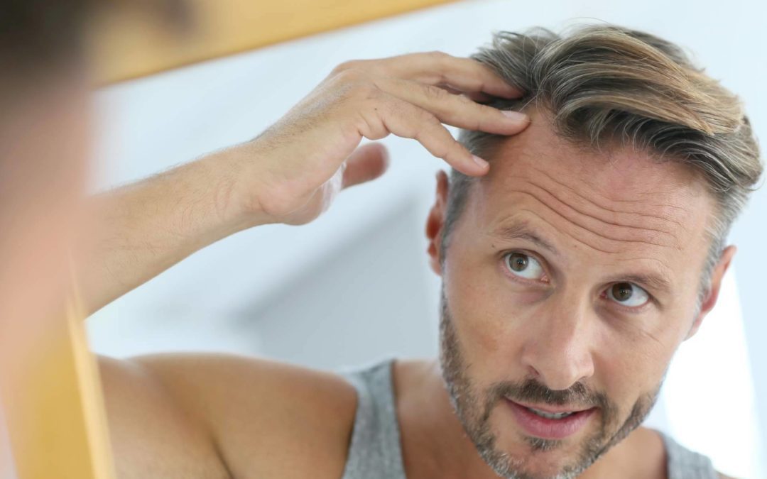 Tratamientos para la alopecia androgénica con Saw palmetto