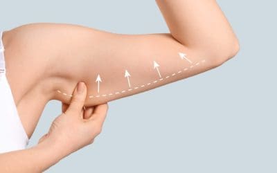 Beauty&Beauty expande su servicio de lifting de brazos en seis ciudades clave de España