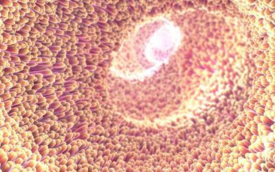Colon irritable; Un diagnóstico impreciso que en muchos casos oculta trastornos reversibles y tratables