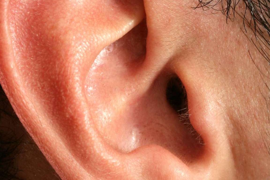 ¿Se ha sufrido ese zumbido constante en los oídos? Podría ser tinnitus
