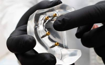 Clínica Calvo de Mora ofrece implantes dentales avanzados con enfoque multidisciplinar en Madrid