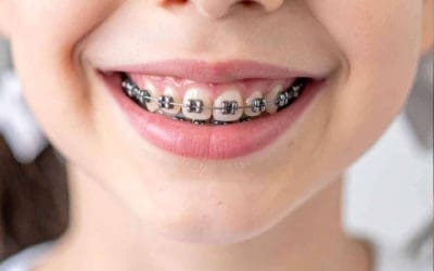 Ortodoncia infantil; guía para una sonrisa saludable desde pequeños