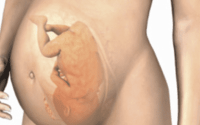 Detenida en Majadahonda una chica de 18 años por ocultar un feto muerto de 7,5 meses: autopsia por aborto espontáneo o asesinato