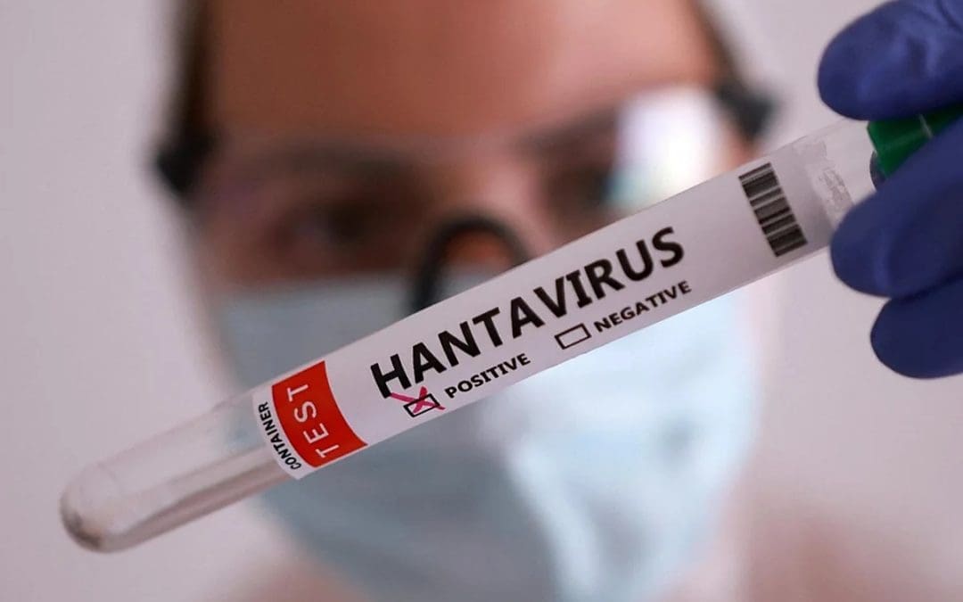 El único laboratorio de España que analiza el Hantavirus está en Majadahonda: así se hacen las pruebas