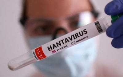 El único laboratorio de España que analiza el Hantavirus está en Majadahonda: así se hacen las pruebas